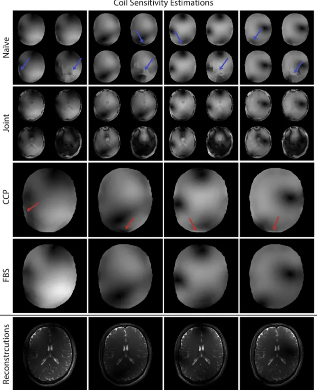 FIGURE 5 Coil sensitivities were estimated during Naïve, Joint, CCP and FBS reconstructions