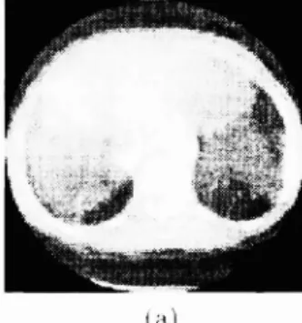 Figure 3. 'tIn' niagnit 11(10 of thit- displacement estmiat loll error vector ( (i1 ), ((I')).