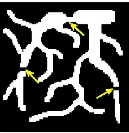 Figure 3.2: Numerical vessel phantom used in the simulations. Arrows show the regions with stenosis.