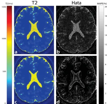 Şekil 2: İki yöntemle tahmin edilen T1 zamanı (a,c) ve karşılık  gelen ortalama mutlak yüzde hata haritaları (b,d)