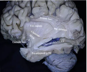 Fig. 4    Deep to the anterior aspect of the parahippocampus pes hip- hip-pocampi was observed
