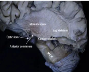 Fig. 6    The MCP was removed and the SCP and midbrain structures  were exposed