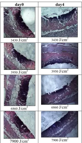 Figure 3: Histologic images of the tissue samples after modulated Tm:YAP  laser applications in Table 1 