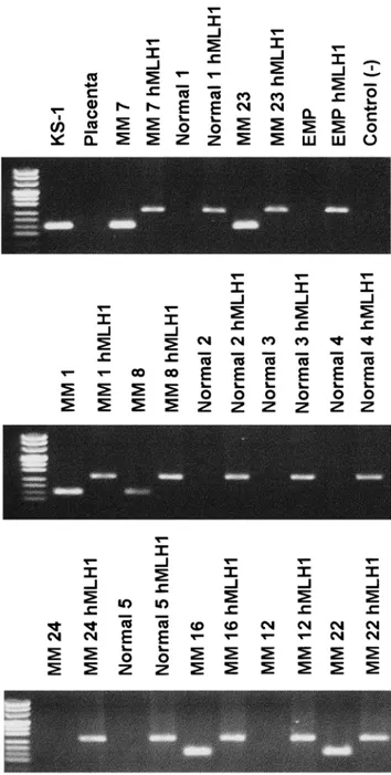 Figure 4 DNA-PCR ampliﬁcation results on samples from patients with MM (MM 1, 7, 8, 12, 16, 22, 23, 24); EMP and ﬁve normal controls performed in an independent laboratory in Turkey using the vIRF(ORFK9) and hMLH1(human mismatch repair gene) primers.