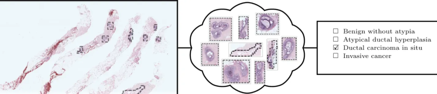 Figure 1. An example slide, manually annotated ROIs, and the diagnosis of the slide.