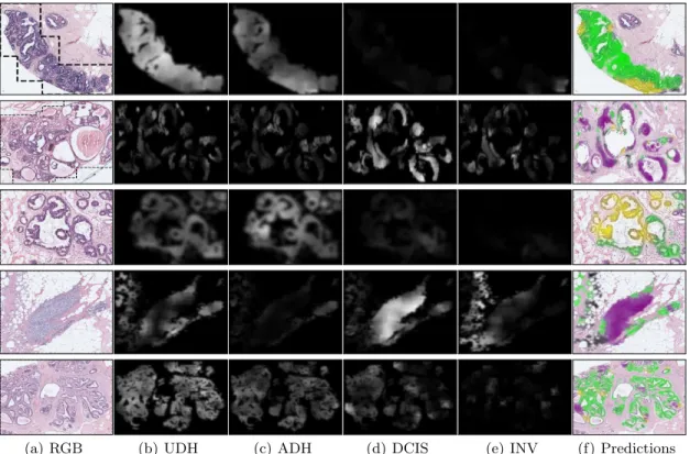 Figure 4. Patch-level classification outputs from CNN on an example ROI. From left to right: RGB image of an ROI;