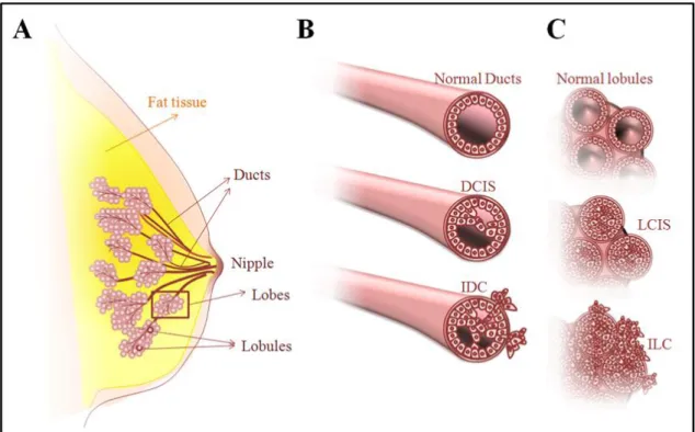 Figure 1.1. Structure of normal breast tissue and development of breast cancer. 