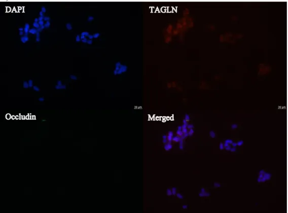 Figure 3.5. Co-immunofluorescence staining of MDA-MB-361 cells. 
