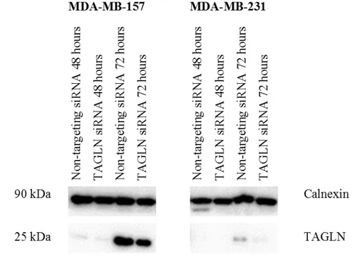 Figure 3.6. TAGLN gene was silenced in MDA-MB-157 and MDA-MB-231 cells  with TAGLN siRNA after 72 hours of treatment