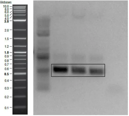 Figure  12-  Amplified  csgB  gene  fragments  ~500bp  shown  in  the  square.  Negative  control was on the last lane 
