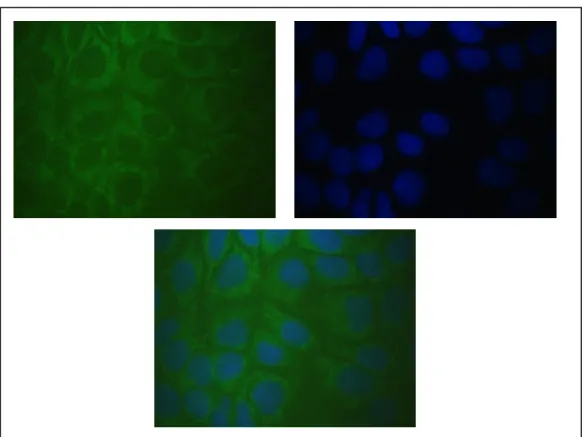 Figure 3.5: Immunocytochemistry of Ccdc-124. HeLa cells were fixed and stained with polyclonal  anti-124 antibody and FITC conjugated anti-rabbit antibody