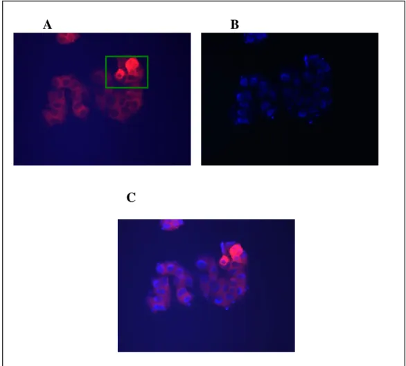 Figure 3.6: Immunocytochemistry of Ccdc-124. pCMV-Ccdc-124 transfected HeLa cells were fixed  and  stained  with  polyclonal  anti-Ccdc-124  antibody  and  TRITC  conjugated  anti-rabbit  antibody