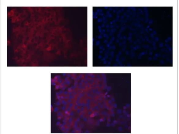 Figure  3.10:  Immunocytochemistry  of  Ccdc-124.  pCMV-Ccdc-124  transfected  MCF-7  cells  were  fixed and stained with polyclonal anti-Ccdc-124 antibody and TRITC conjugated anti-rabbit antibody