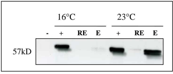 Figure 3.17: Western blot analysis of pQE80L RasGEF1B with anti-Histidine antibody. “-“ and 