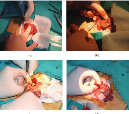 Figure 4: (a) and (b) Traditional partial nephrectomy model with suture on resected area dissection of kidney