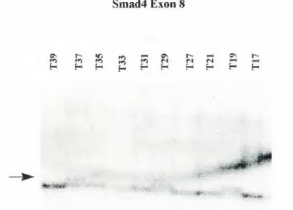 Figure 3.3:  SSCP Analysis of Exon 8