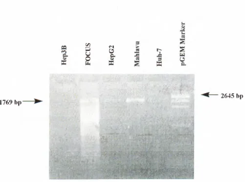 Figure 3.6:  PCR Analysis of Cell Line cDNAs
