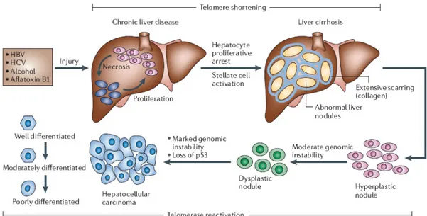 Figure 1.1: Multistage process of hepatocarcinogenesis (2). 