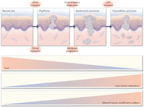 Figure 1.6  Epigenetic Alterations in Tumor Progression, skin tumor as a model (94). 