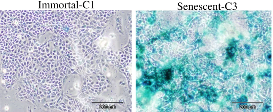 Figure  4.1.1    Senescence  associated  B-galactosidase  (SABG)  staining  of  immortal  and  senescent cells