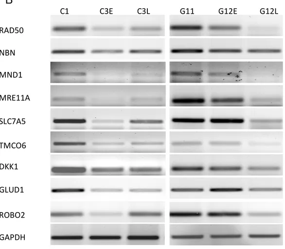 Figure 4.1.5 Confirmation of the microarray data. A) RT-PCR analysis of senescence and,  B) immortal up-regulated genes