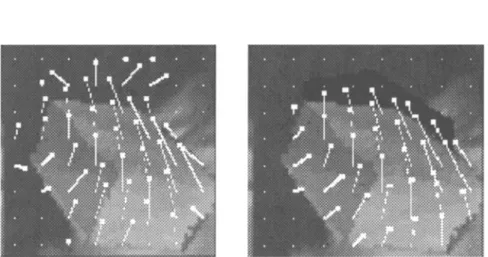 Figure  10  The  (a)  estimated  and  (b)  true  needlegrams  of  "Cube"  on  the  reconstructed  frames