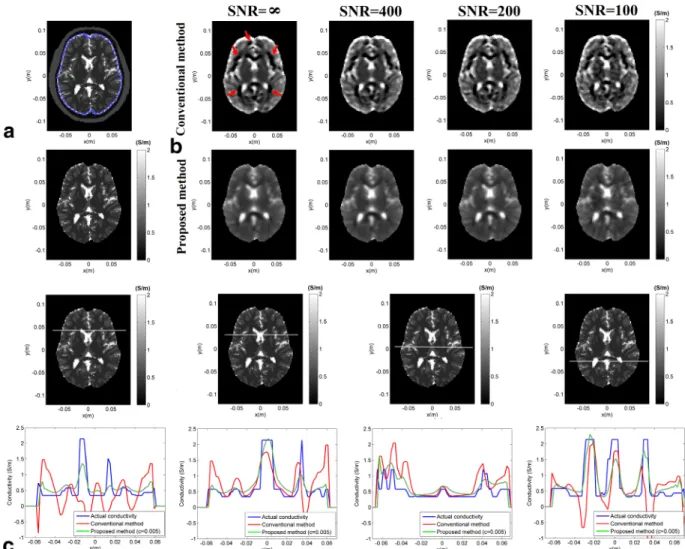 FIG. 3. Human head model simulations: (a) selection of the ROI indicated by the blue polygon (left), the actual conductivity map in the ROI (right); (b) reconstructed conductivity maps using the conventional phase-based EPT method and the proposed method f