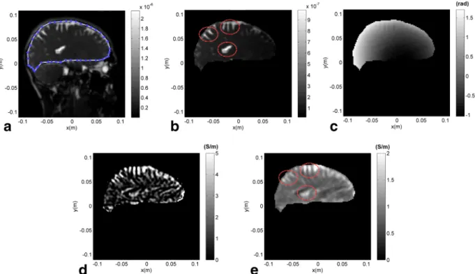 Figure 4 shows the results for the phantom with one anom- anom-aly (described in Fig. 1c)