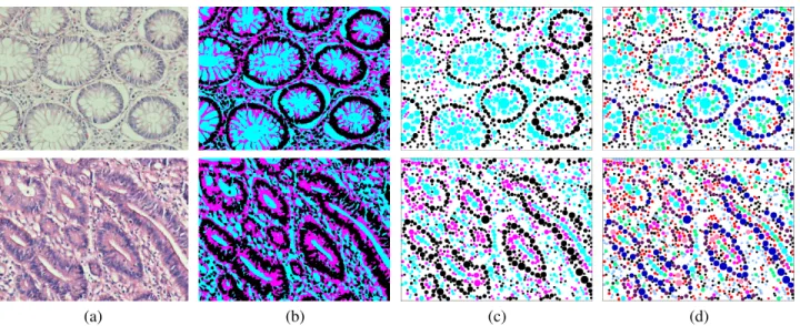 Fig. 2. Graph node definition: (a) original images, (b) quantized image pixels [purple, pink, and white pixels are shown in black, pink, and cyan, respectively], (c) three circle types defined on the quantized pixels, and (d) nine circle types defined base