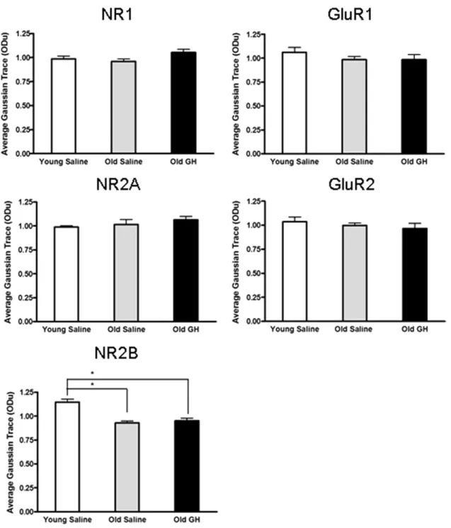 Fig. 6. Assessment of glutamate receptor subunit protein level changes. Densitometric Western blot analysis of subunit proteins in the CA1 region evaluated relative levels of the NR1, NR2A, and NR2B subunits of the N-methyl-D-aspartate (NMDA) receptor, and