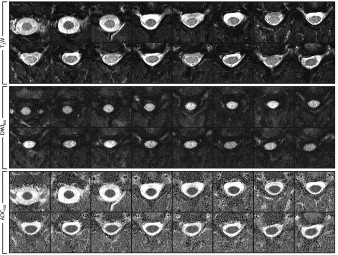 FIG. 8. All 16 slices from the in vivo demonstration of Hadamard slice-encoding scheme with axial DWI of the spinal cord