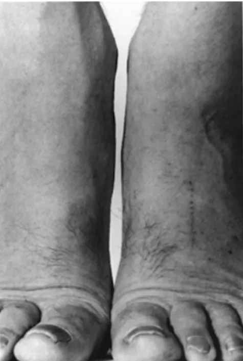 Figure  4.  John  Coplans.  John  Coplans,  Self  Portrait  (Feet  Frontal).  1984  .  