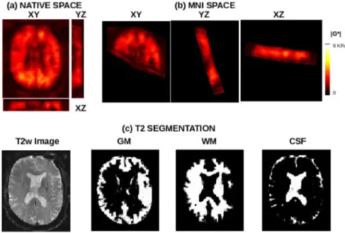 Fig. 5. Example images from segmentation of a second brain. 