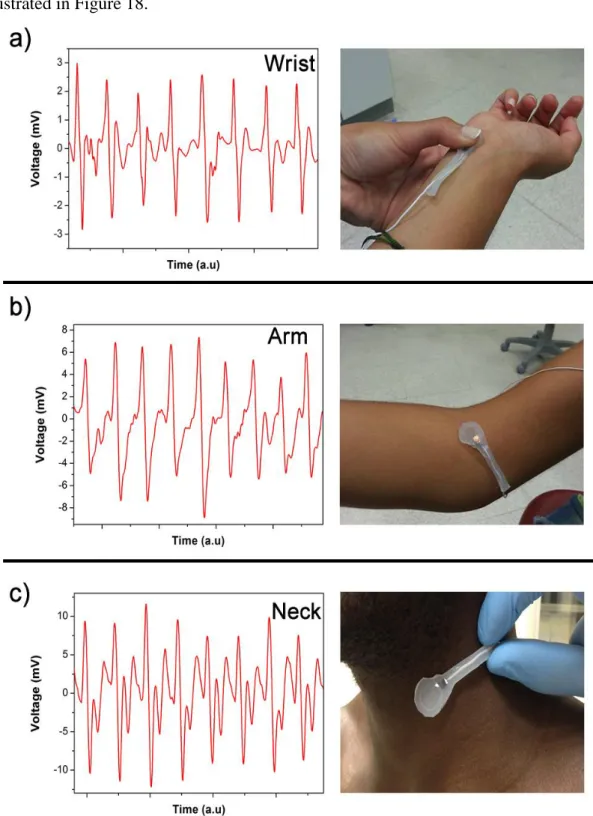 Figure 18. Blood pressure measurements on the wrist, arm and neck. a) Open circuit voltage  (V OC ) - time plot for a sensor placed on the wrist and photograph of the sensor on the wrist