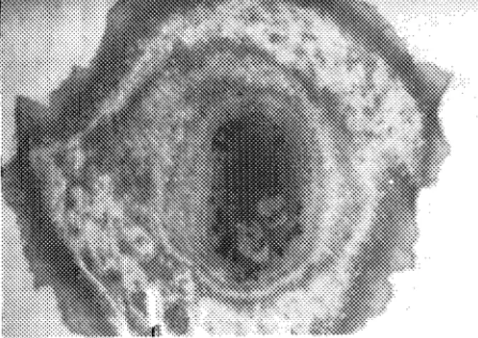 FIG.  11. Acoustic micrograph ofa frog heart cell at a frequency of 1.6 GHz. 