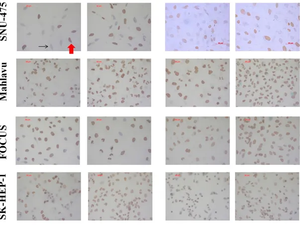 Figure 4.1.1 (continued): Global levels of H3K27me3 in HCC cell lines in the presence or absence  of TGF-β induced senescence; determined by immunoperoxidase staining