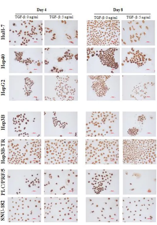 Figure  4.1.2:  Global  levels  of  H3K4me3  in  HCC  cell  lines  in  the  presence  or  absence  of  TGF-β  induced senescence; determined by immunoperoxidase staining