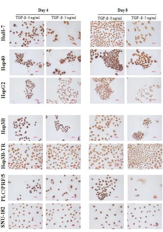 Figure  4.1.2:  Global  levels  of  H3K4me3  in  HCC  cell  lines  in  the  presence  or  absence  of  TGF-β  induced senescence; determined by immunoperoxidase staining