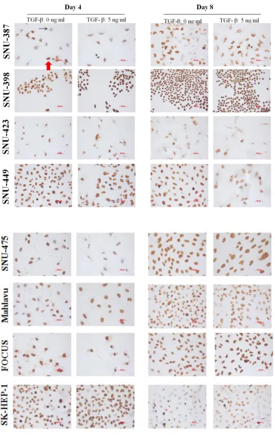 Figure 4.1.2 (continued): Global levels of H3K4me3 in HCC cell lines in the presence or absence  of TGF-β induced senescence; determined by immunoperoxidase staining.