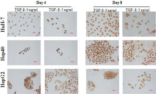 Figure  4.1.3:  Global  levels  of  H3K9me3  in  HCC  cell  lines  in  the  presence  or  absence  of  TGF-β  induced senescence; determined by immunoperoxidase staining