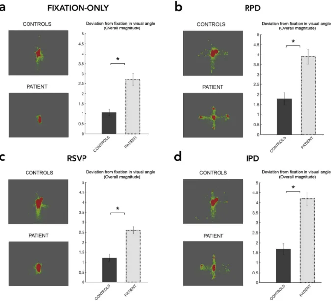Table 1 shows raw scores and norms for each administered test. The patient's performance was within the normal range for tests of early  vi-sual-, and visuo-perceptual processing and object perception