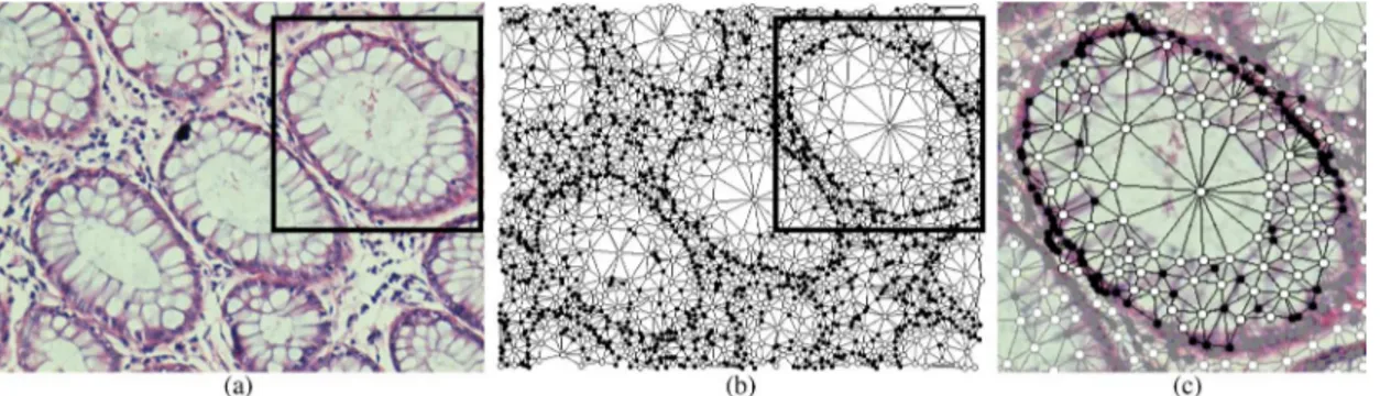 Fig. 2. An illustration of the graph generation step: (a) an example normal tissue image, (b) the tissue graph generated for this image, and (c) a query graph generated to represent a normal gland.