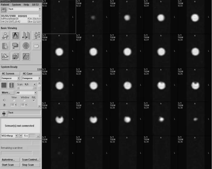 Fig. 4. Typical axial image slices of a passive fiducial marker employed in the experimental evaluation on a 3-T Phillips Intera MRI Scanner
