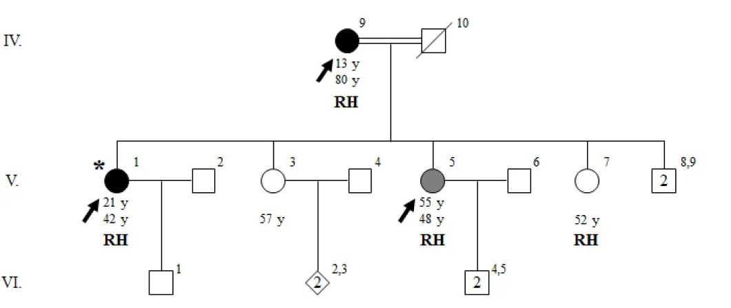 Figure  7  Pedigree  of  family  ET-17  with  genotypes  at  SNCAIP  p.R853H.  Age  at  onset  of  tremor  for  affected  individuals,  current  ages,  and  genotypes at SNCAIP p.R853H are indicated in this order under the symbols