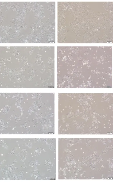 Figure  4.4:  Morphological  effect  of  Cardiac  glycosides  Lanatoside  A,  Lanatoside  C  and  Glucogitorosid  on  Huh7  and  Mahlavu  human  liver  cancer  cell  lines  (10x) 