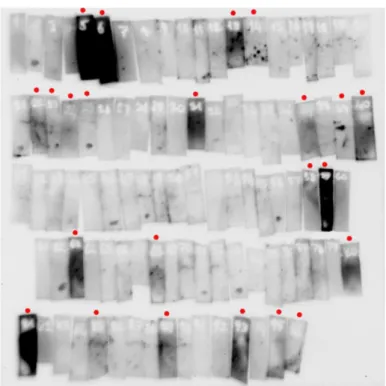 Figure  10.  SCLC  sera  causing  undesirable  background  staining.  Each  strip  correspons to a single serum