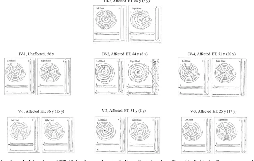 Figure 3.3 Archimedes spiral drawings of ET-49 family members including affected and unaffected individuals