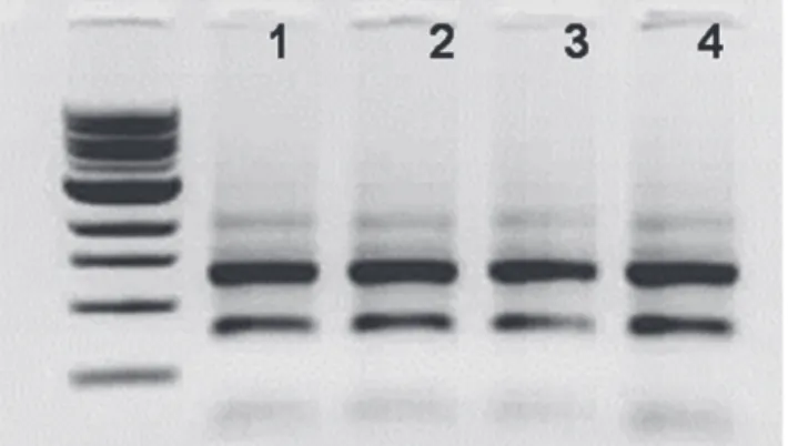 Figure 2: Xbp-1 splicing assay. Unspliced Xbp-1 gives 283 bp and  spliced Xbp-1 gives 257 bp fragment