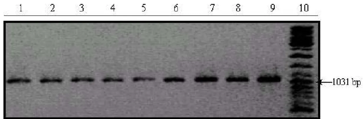 Figure 3.2: RT-PCR analysis of 5’ hCdc4 cDNA using 1F and 3R primers. (1047 bp. product)  Lanes: 1) Huh7 2) Hep3B-TR 3) Focus 4) Mahlavu 5) Hep40 6) Hep3B 7) PLC 8)SK-Hep1  9) Snu475 10) Marker: Gene Ruler DNA Ladder mix 