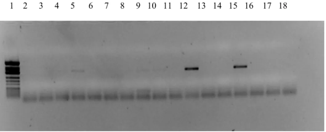 Figure 3.3: Agarose gel electrophoresis of PCR1 products.  Lane 1: 